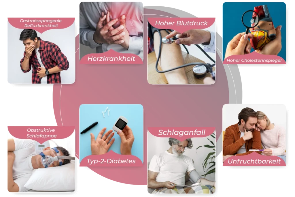 Einige-Beispiele-die-mit-einer-Magenbypass-Operation-geloest-werden-koennen