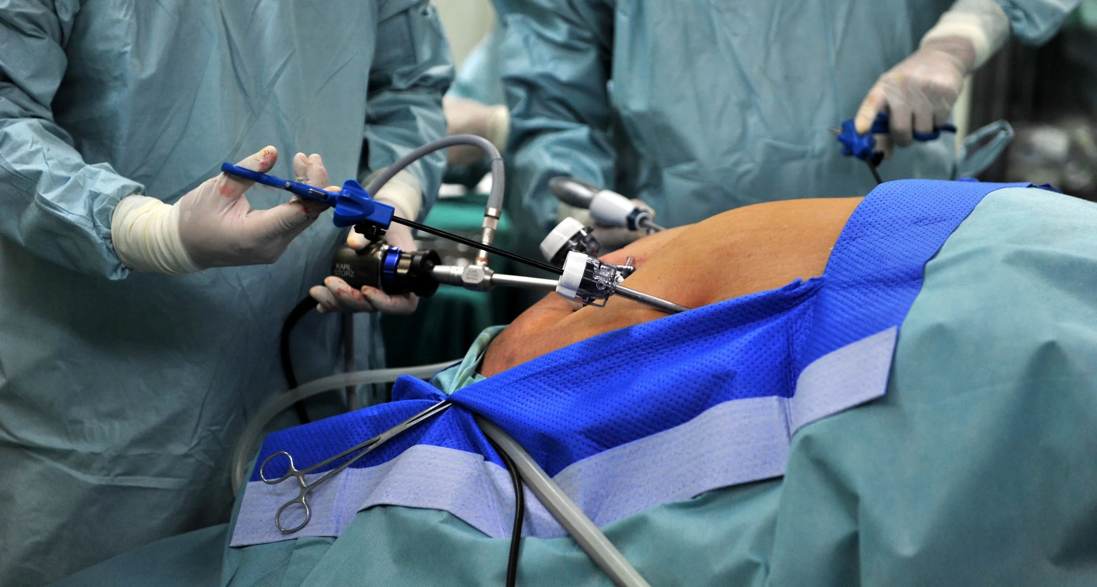 Vorteile und Risiken der Adipositas-Chirurgie - | Magenverkleinerung Aesthetic Travel